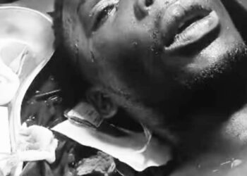 Ssenyonyi demands government compensation for injured journalist Miracle Ibrah