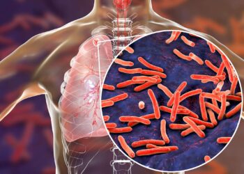 Funding Crisis Jeopardizes TB Efforts