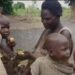 At 33, Akoli Has 12 Children, No Food to Feed Them