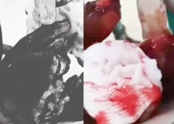 Viral Video on Alleged KIU Student Mutilation Fake, Police