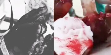 Viral Video on Alleged KIU Student Mutilation Fake, Police