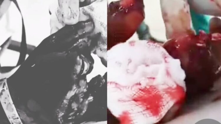 Viral Video on Alleged KIU Student Mutilation Fake, Police