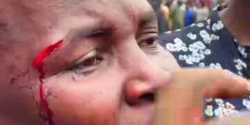 Hamis Kiggundu’s Guards Beat Up Traders Over Nakivubo Flood Protest